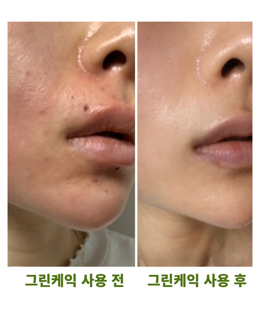 그린케이크 이미지