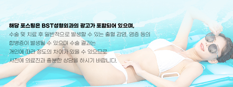 비에스티성형외과의원 이미지