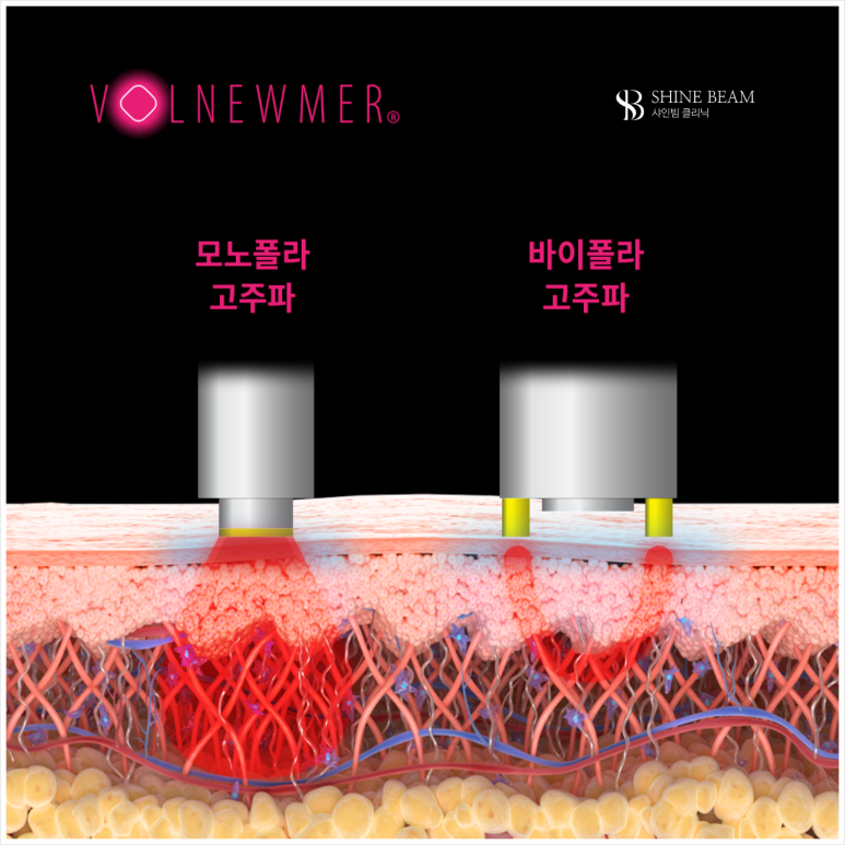 샤인빔의원 이미지