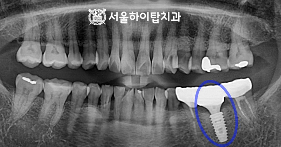 서울하이치과의원 이미지