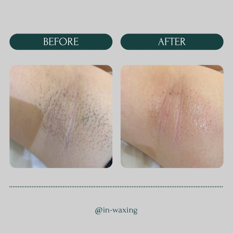 in_waxing 이미지
