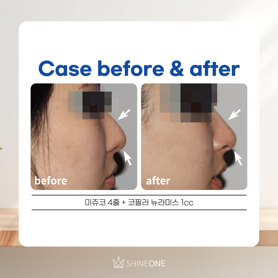 더샤인원 이미지