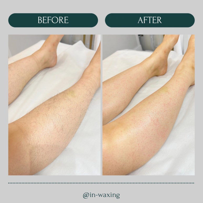 in_waxing 이미지