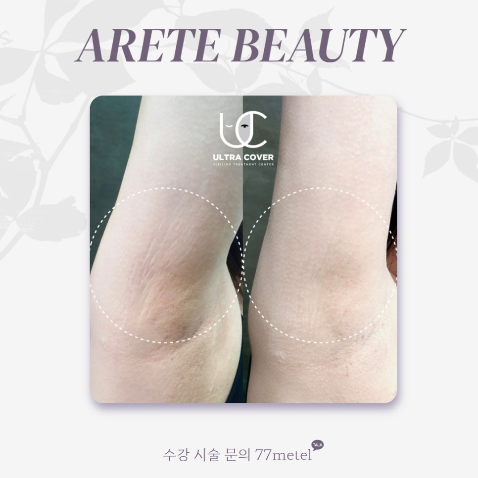 52아레테 이미지