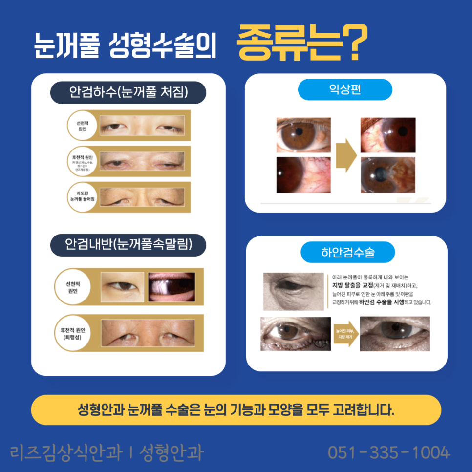 아름다운눈안과 이미지
