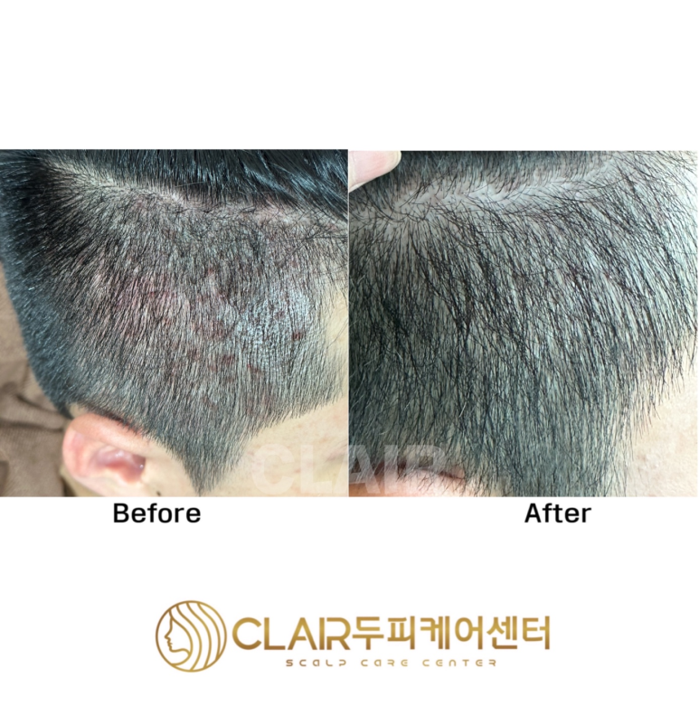클레르두피케어센터 이미지