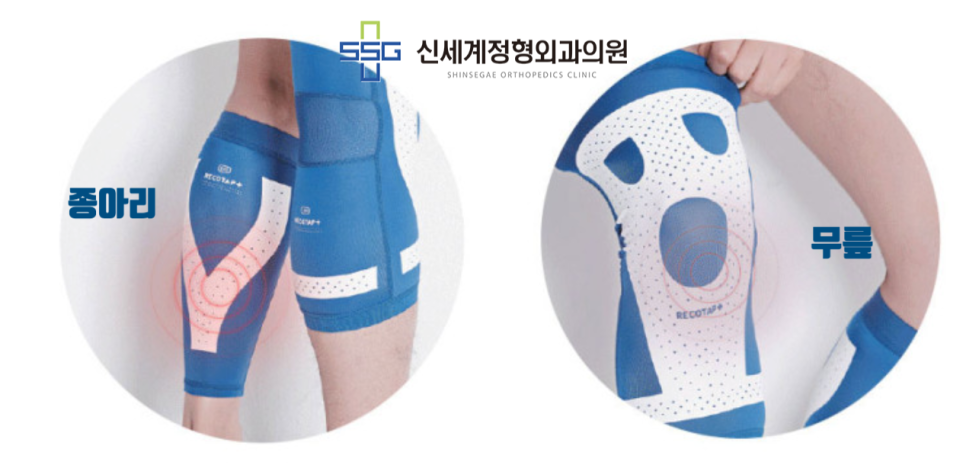 리코플러스 이미지
