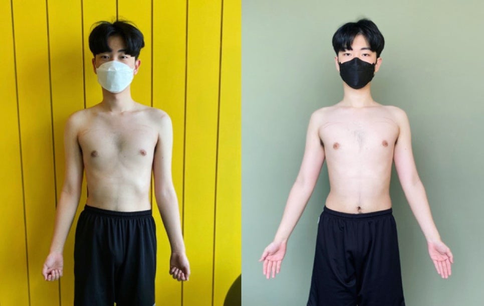 오이이핏 이미지