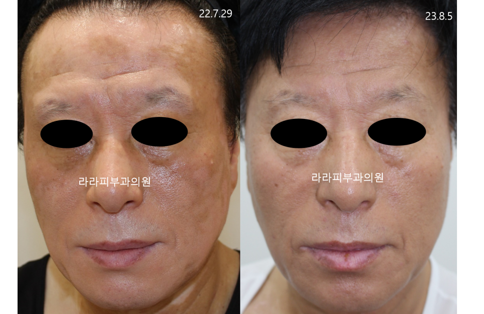 라라피부과의원 이미지