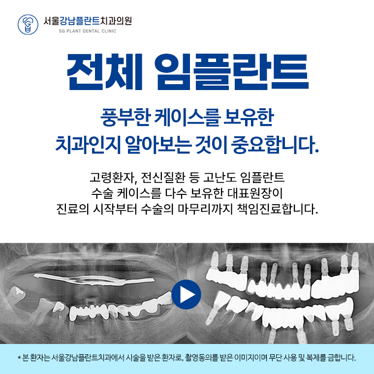 서울강남플란트치과 이미지