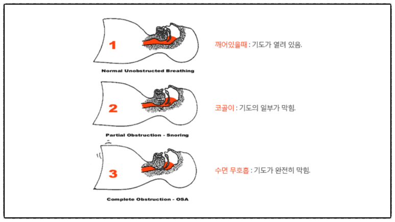 비보스 이미지