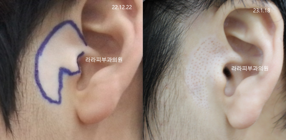 라라피부과의원 이미지