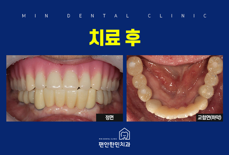 편안한민치과 이미지