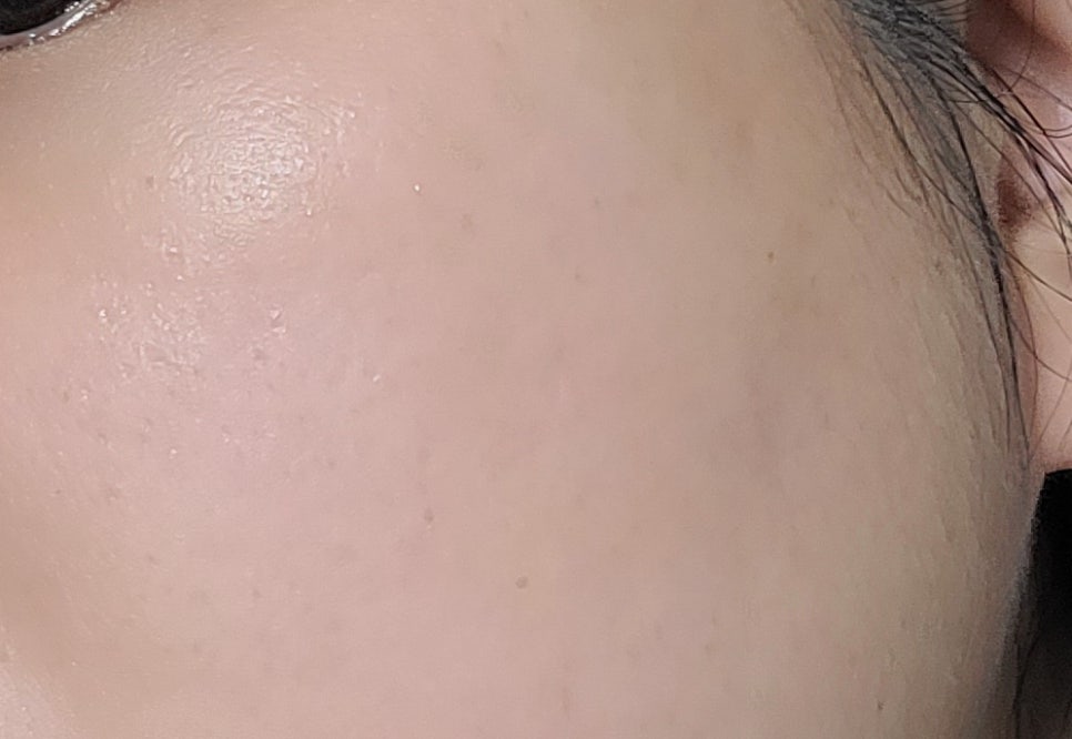 삼십육점오 이미지