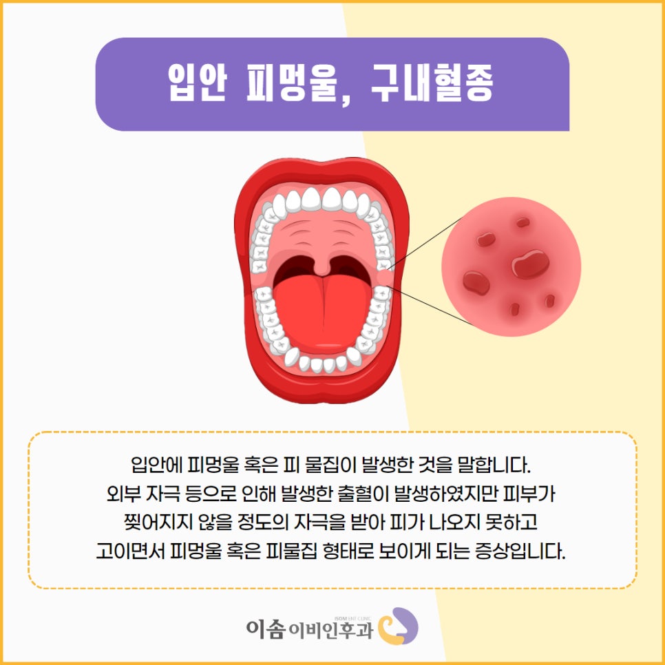 이솜이비인후과 이미지