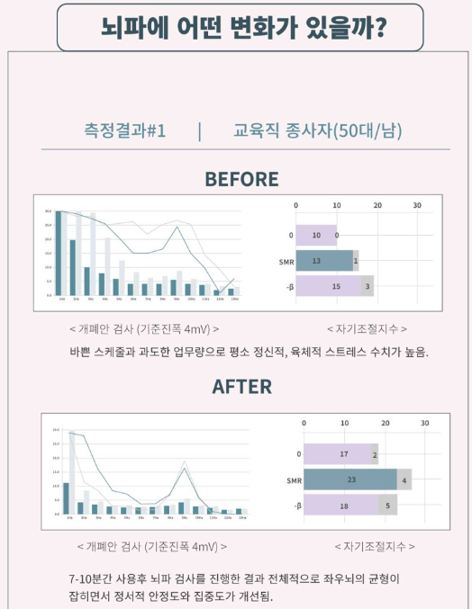 인터네셔널에이피 이미지
