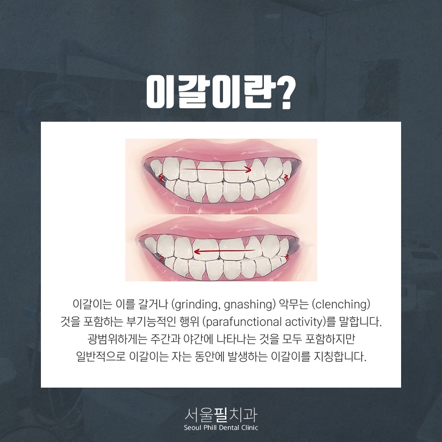서울필치과의원 이미지