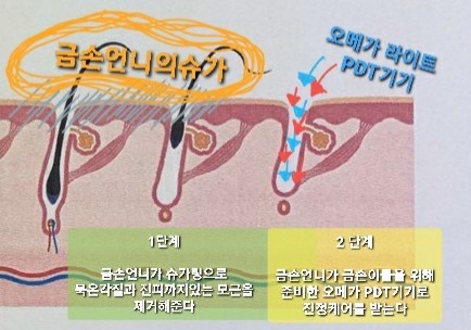 금손언니 이미지