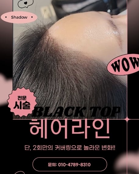 탑커버링 이미지