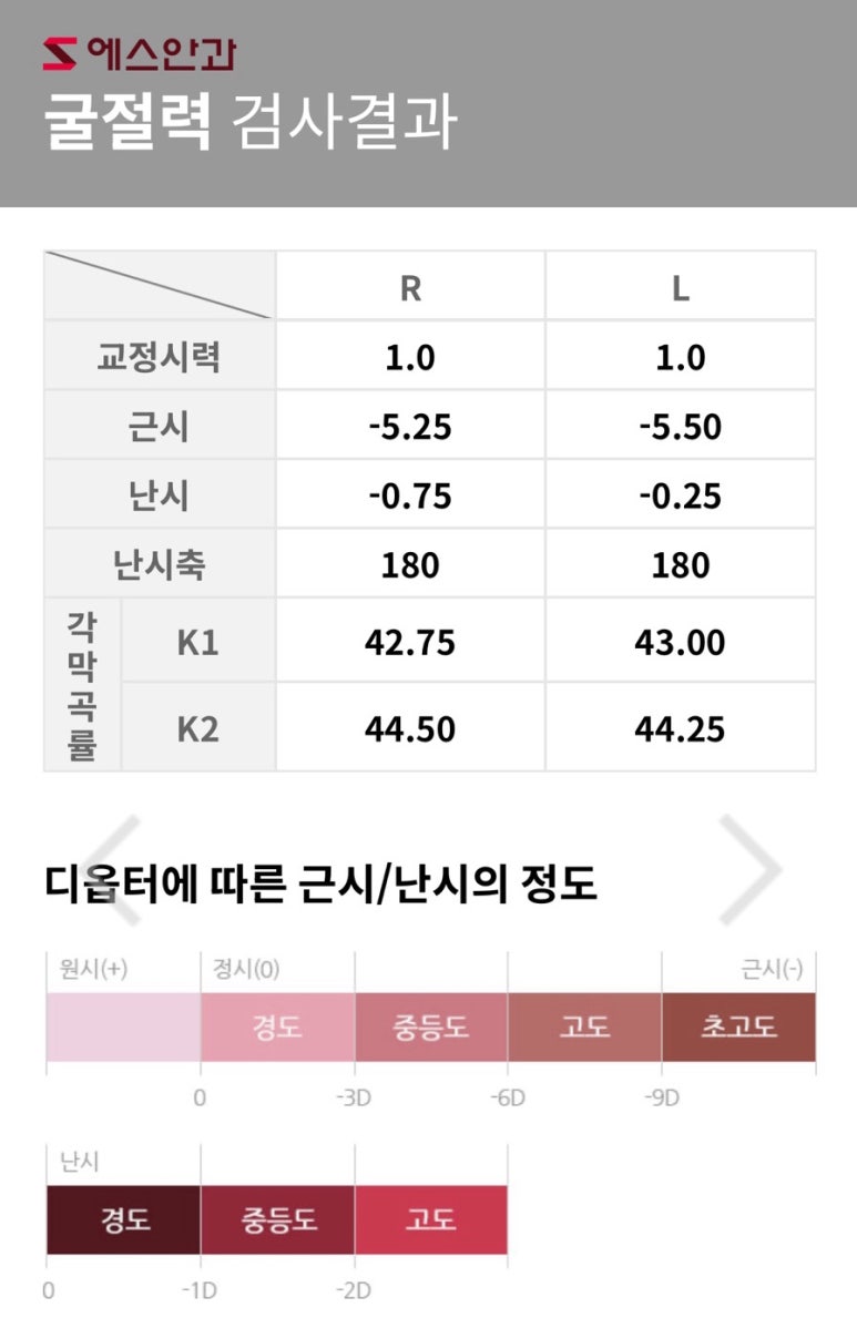 에스안과의원 이미지