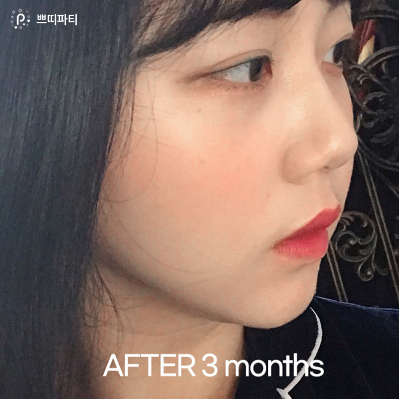 여우라인 이미지