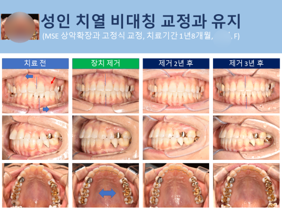 가지런-e치과의원 이미지