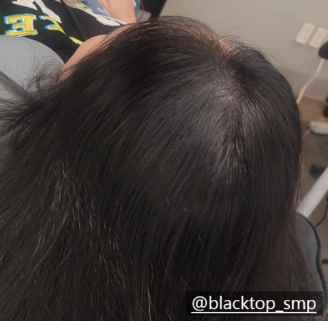 탑커버링 이미지