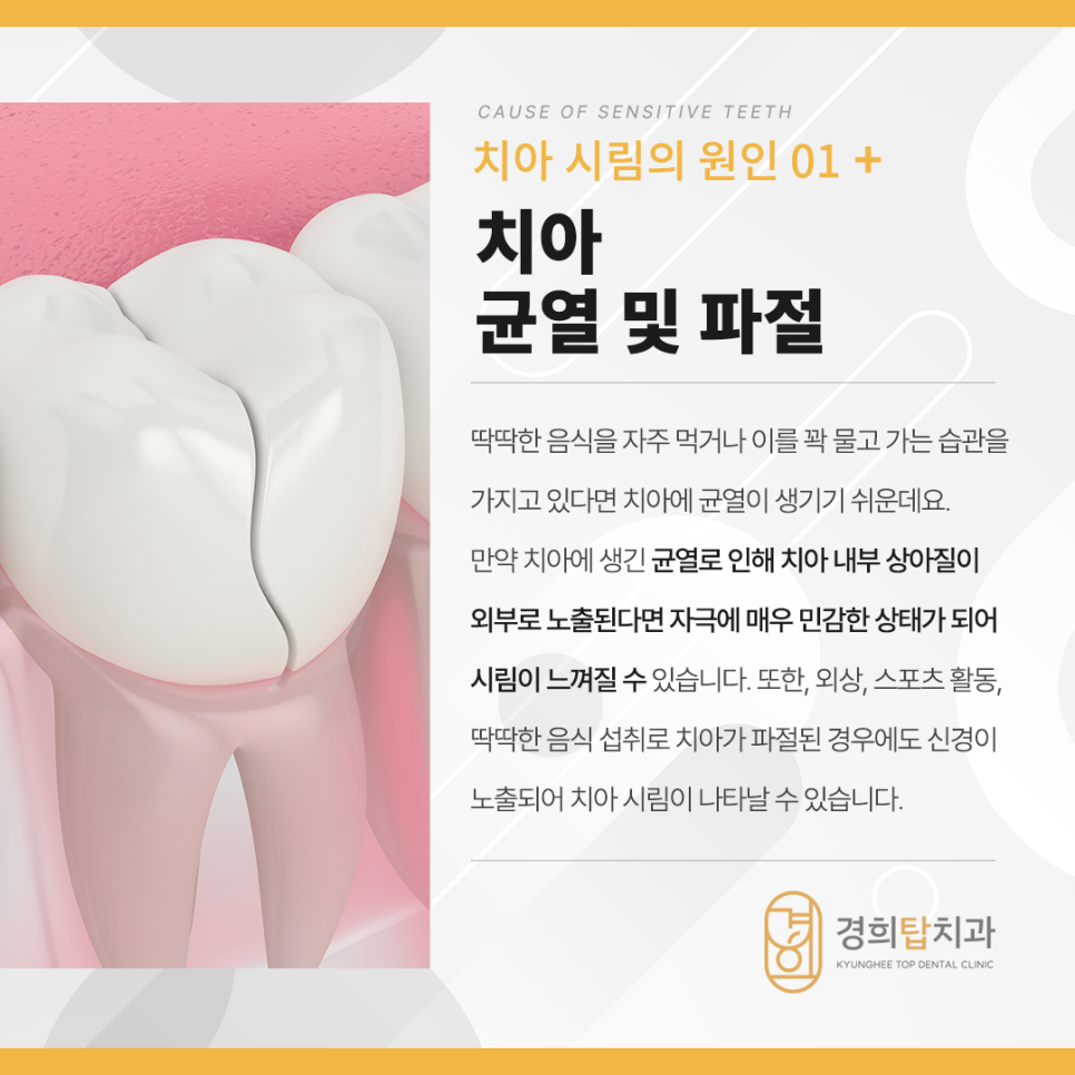경희탑치과의원 이미지