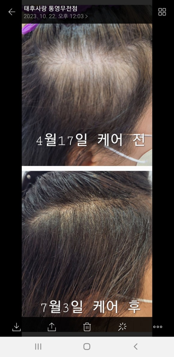 두피·탈모태후사랑하남점 이미지