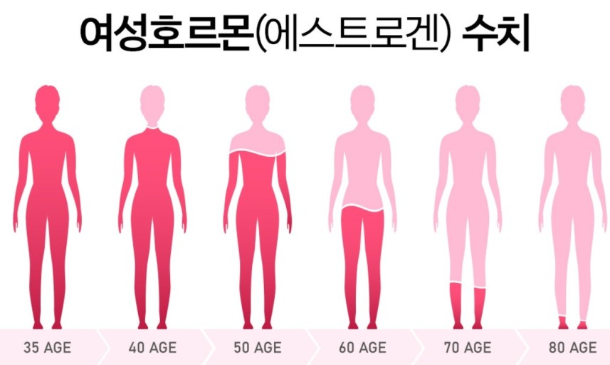 골드스파 이미지