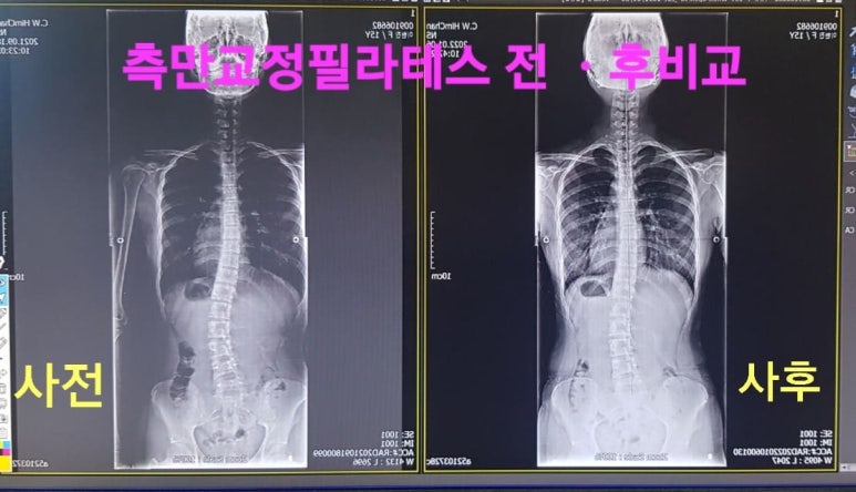 RBT체형교정운동센터 이미지