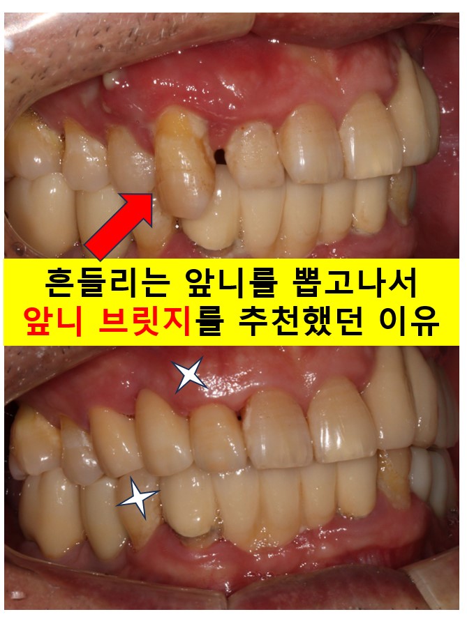 백플란트치과의원 이미지