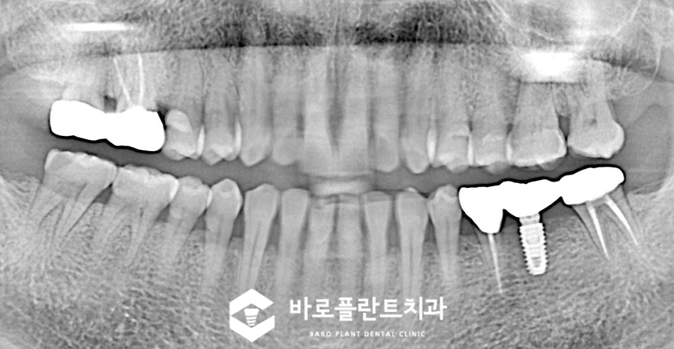 오늘바로플란트치과의원 이미지