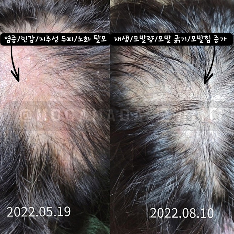 블래스유 이미지