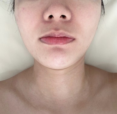 에스테틱서윤 이미지