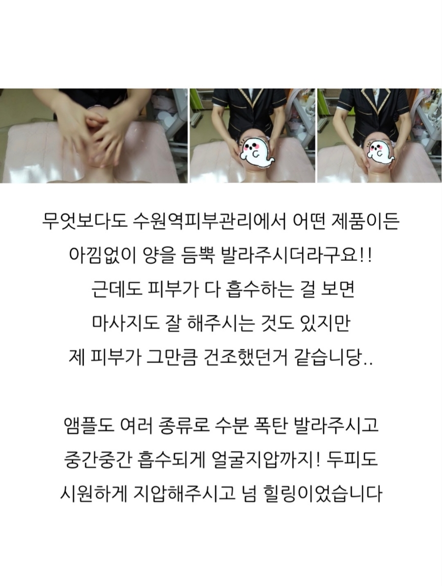 에스케어 이미지
