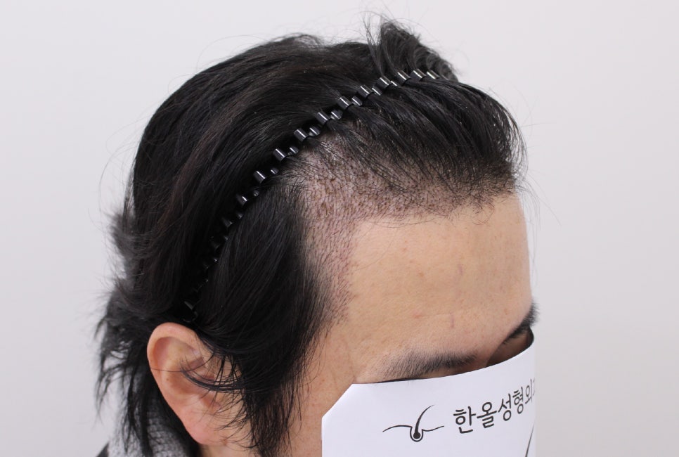더헤어라인성형외과의원 이미지