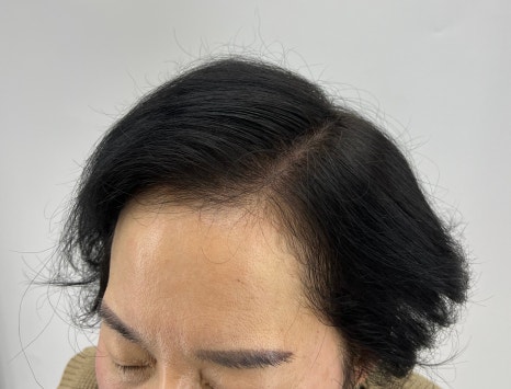 픽스칼프 이미지