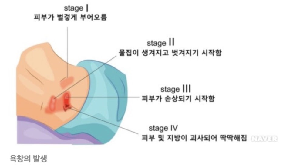 조은케어 이미지