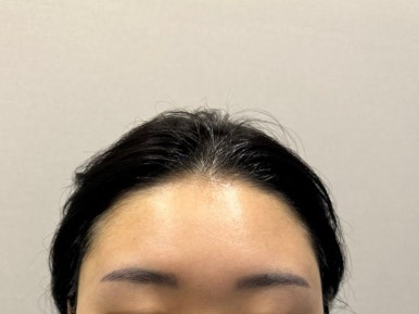 조헤어라인 이미지