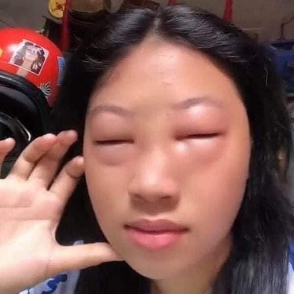 Dday 이미지