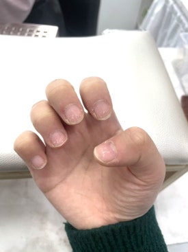 네일블레 이미지