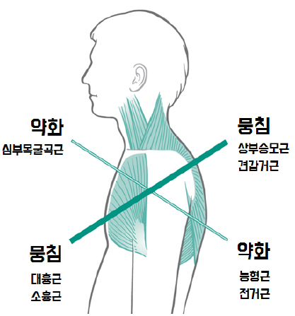 디오엠 이미지