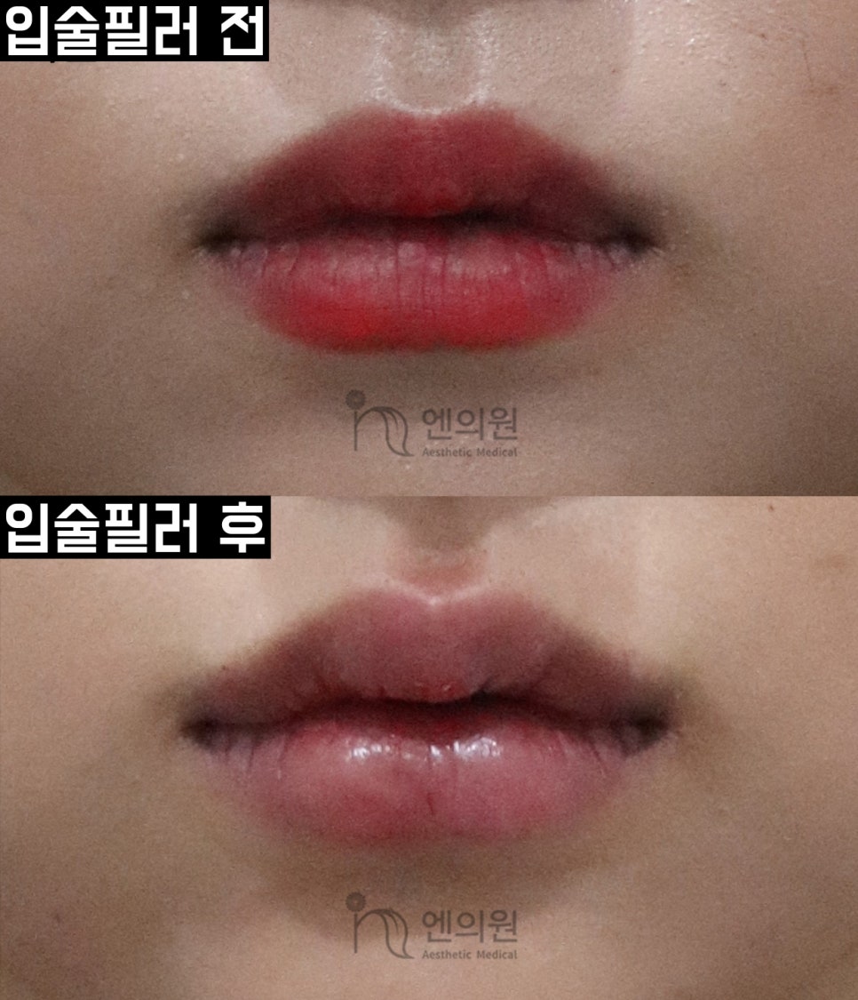 엔의원 이미지