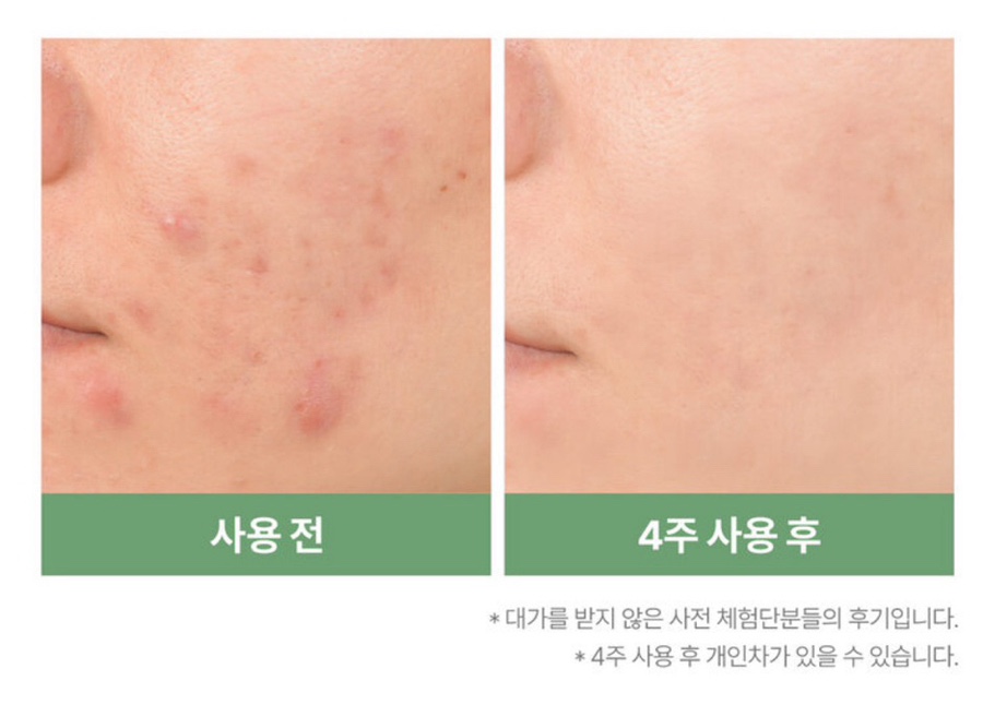 버블클린 이미지