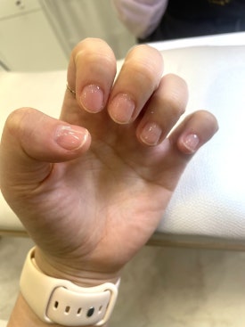 네일블레 이미지