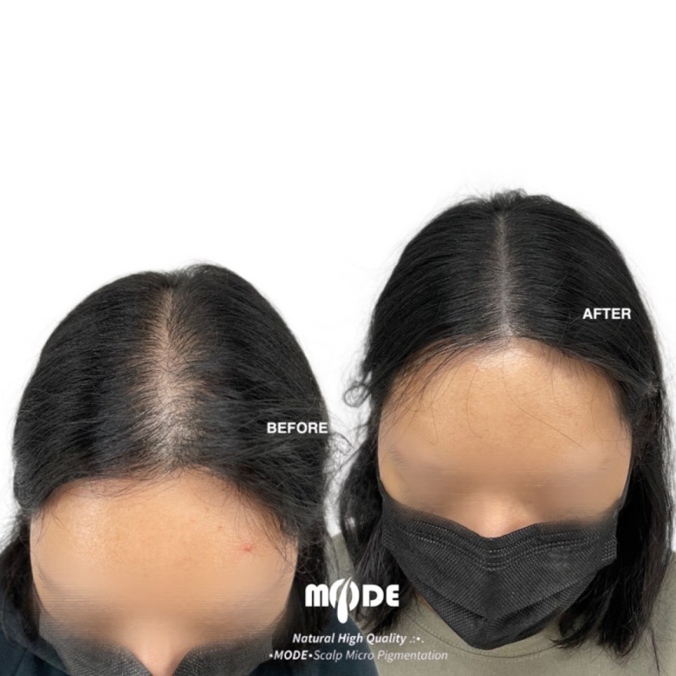 헤어팡팡&가발 이미지