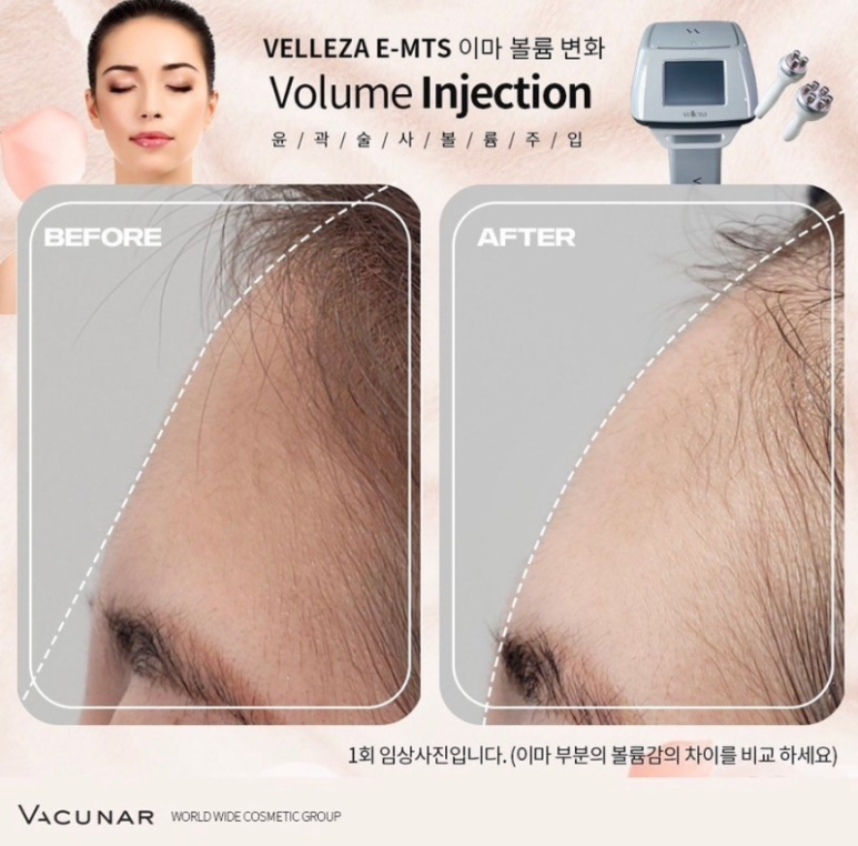 에스테라파 이미지