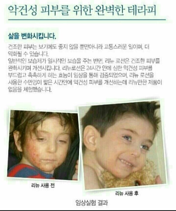 리뉴바디 이미지
