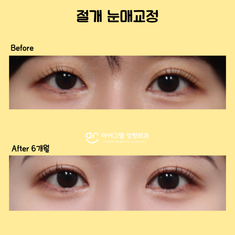 아이그램성형외과 이미지